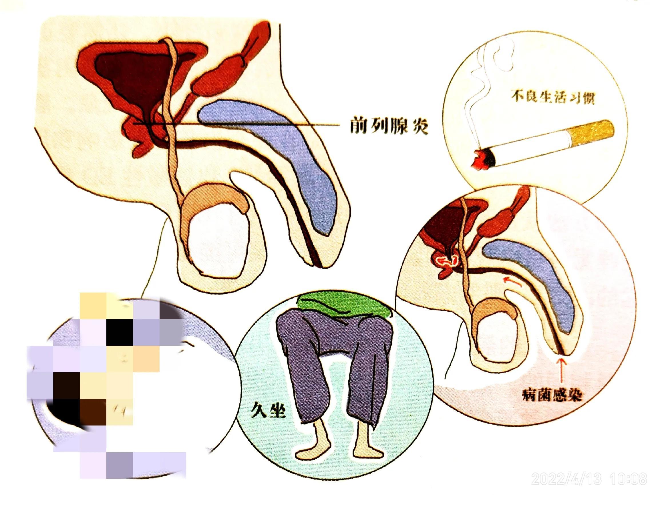 最新疾病圖